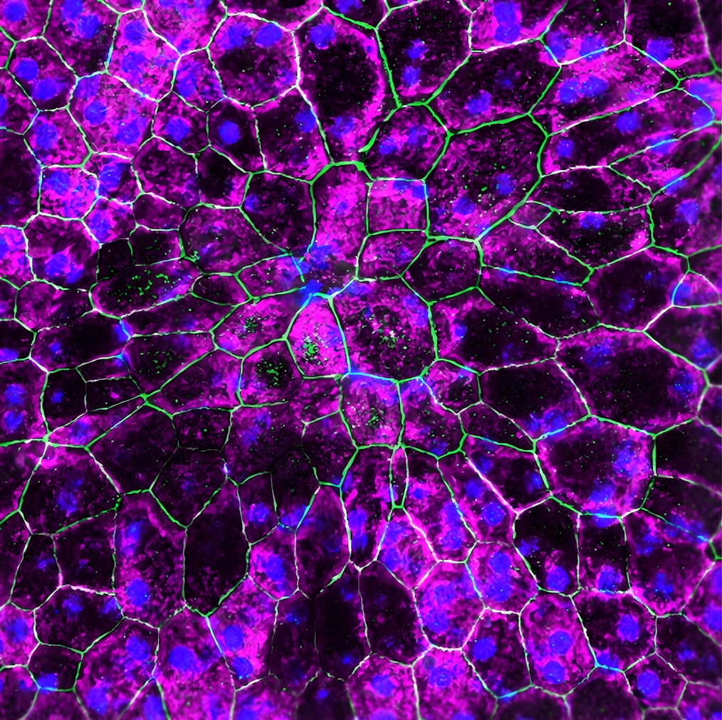 rescued retinal pigment epithelium cells after gene therapy