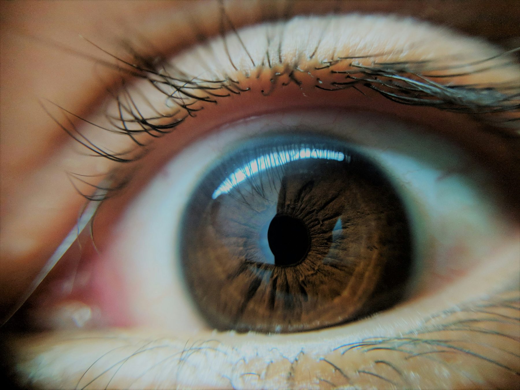 Diagram of the retina showing the macula affected by Best disease