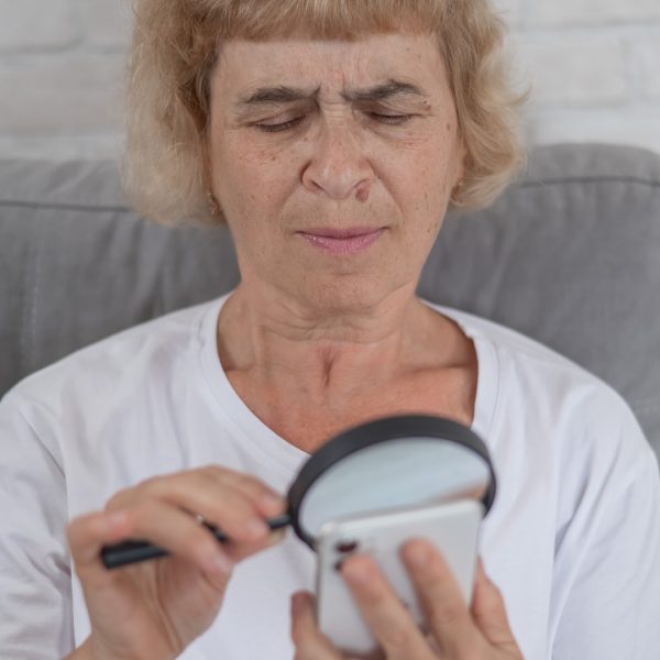 Age-related macular degeneration (AMD)