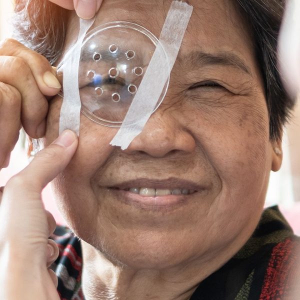 Diabetic Retinopathy