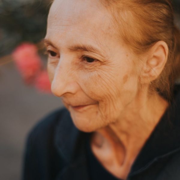 Sjogren’s Syndrome