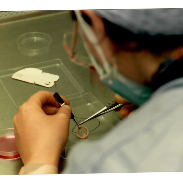 A cornea being prepped for transplant